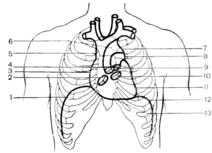 Topográfiája Heart - klinikai anatómiája a szív