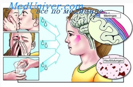 Tuberkulotikus meningitis-(elsővonalbeli szerek) gümőkóros agyhártyagyulladás