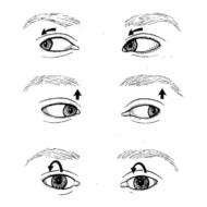 exerciții de astigmatism de vedere pentru ochi