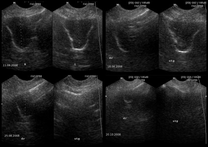 Uzi orrmelléküregek (Előadás diagnostere)