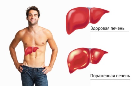 Vakcina a hepatitis import, hazai (szemben) Vakcina a hepatitis import, belföldi