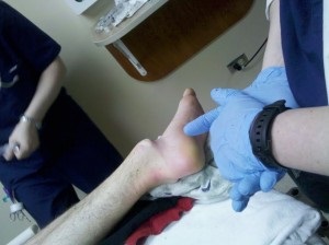 Ficam láb tünetek és a kezelés, hogy mi a teendő, ha a subtalaris zavar a láb