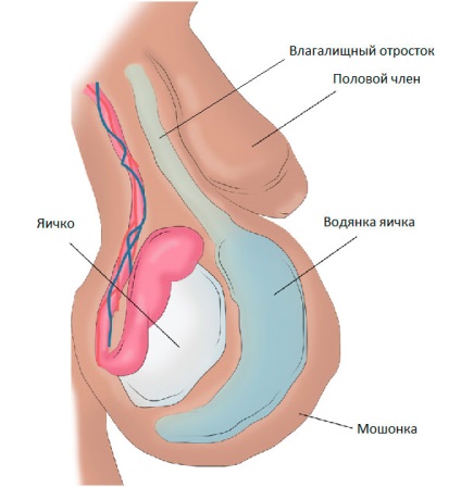 Hydrocele - tünetek, okok, diagnózis, kezelés hydrocephalus lyaichka, megelőzés és (tünetek) Hydrocele - tünetek, okok, diagnózis, kezelési módszerek vízkór lyaichka, megelőzésére és