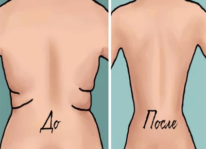 4 egyszerű gyakorlatok, hogy megszabaduljon a ráncok a hátán és az oldalán 3 hétig 1
