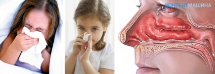 Allergia pornak a gyermek tünetei és kezelése