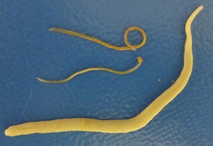 Worms fogyókúra jellemzői és azok hatásmechanizmusa a személy (személyek) Worms fogyókúra jellemzői és azok hatásmechanizmusát az emberi