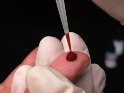 Hogyan tisztítsa meg a tartályokat, takarítás véredények népi jogorvoslat