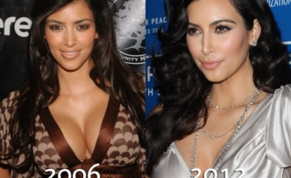 Hogyan Kim Kardashian lefogyott terhesség után 300