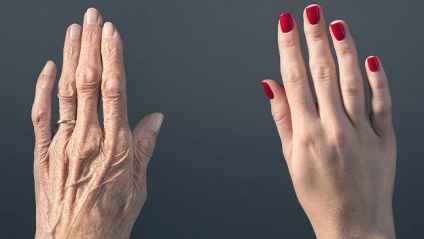 Hogyan lehet megállítani a kezében az öregedés
