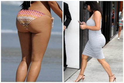 Kim Kardashian előtt és után plasztikai sebészet fotók és videó