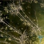A cisztás glia agyi változások kezelésére, a tünetek, okok (tünetek) A cisztás gliasejtek agyi változások kezelésére, a tünetek, okok
