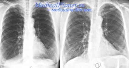 Clinic asztmaroham (asztma) asztmaroham klinika