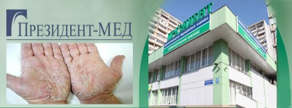Psoriasis kezelésére Moszkva klinikák, egészségügyi központok