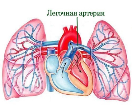 A pulmonális artériába, pulmonális artéria betegség