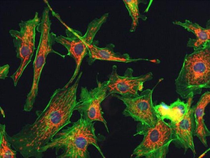Fluoreszcens mikroszkóp jellemzői a vizsgálat (mikroszkópos) Fluoreszcens mikroszkóp különleges tanulmány