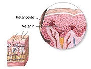 Melanocita - ez (amely közvetlenül gátolja a melanociták) Melanocita - ez