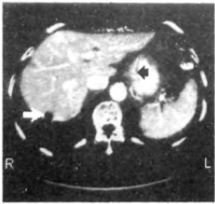 Diagnosztikai módszerek a gyomorrák (gyomor) Diagnosztikai módszerek a gyomorrák