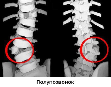 MRI (ellenőrzés) a gerinc, hogy az eljárás