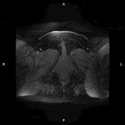 MRI a medencei szervek 1