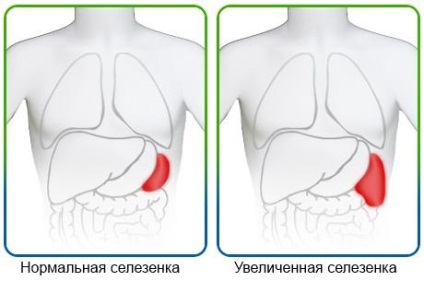 Normál lép méretét felnőtteknél (lép) Normál lép méretét felnőtteknél