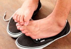 Kopás a lábujjak között okok és a kezelés