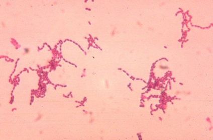 Peptostreptokokki (Peptostreptococcus)