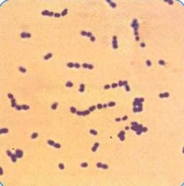 Peptostreptokokki (született Peptostreptococcus)