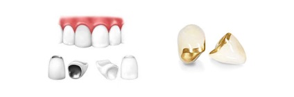 Fokozott fogászati ​​kopás - tünetek és kezelési módszerek
