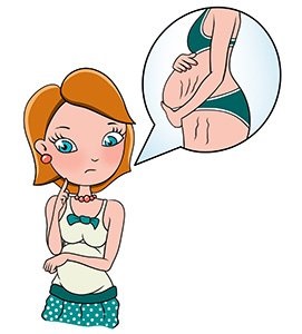Stretch jelek a terhesség alatt, mammyclub (valószínűségét a terhességi csíkok) Striák a terhesség alatt, mammyclub
