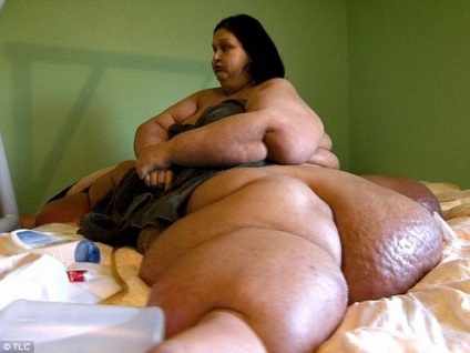 A legkövérebb nő a világon előtti és utáni képek (legyen mondjuk, május 25, 2015)