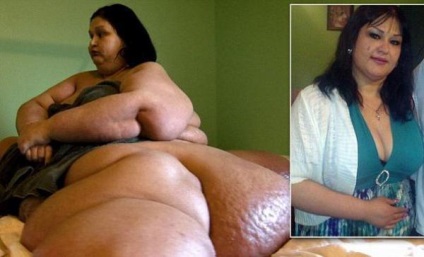 A legkövérebb nő a világon előtti és utáni képek (legyen mondjuk, május 25, 2015)
