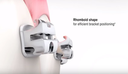 Önszabályozó (bezligaturnye) Braces (önszabályozó zárójelben) Önszabályozó (bezligaturnye) Braces