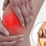 A standard kezelés osteochondrosis (arthritis a térdízület) A standard kezelés osteochondrosis