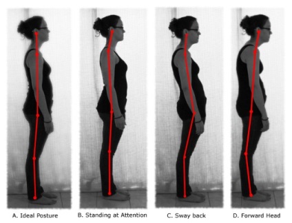 Jó testtartás - a garancia az egészség (Health) Jó testtartás - a garancia az egészség