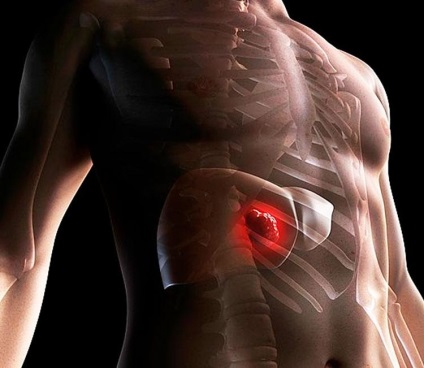 máj adenoma kezelése fájdalom a hasban a férfiakban a prostatitisben