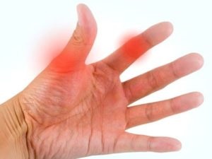 Bursitis ujját jelek, tünetek, kezelés