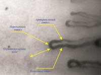 Diagnózis organizmus keresztül capillaroscope (kordiceps) Diagnózis organizmus keresztül capillaroscope