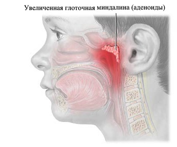 Otthon, családi Clinic - egészséges gyermekek