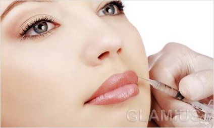 Hogyan lehet eltávolítani az ajkak Botox - Botox rossz