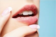Hogyan lehet eltávolítani az ajkak Botox - Botox rossz