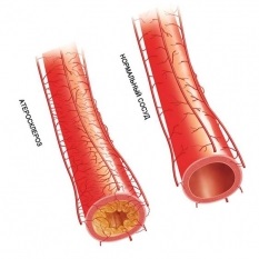 Capillaroscopy - mint az egészségügy vizsgálati módszer