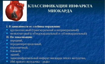 miokardiális infarktus kezelésére és a terápia
