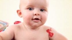 Tűnő pigmentált foltok okainak gyermekek kezelésére