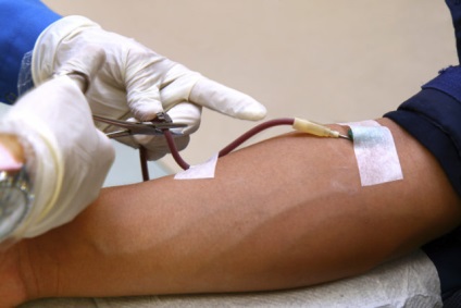 Переливання крові при фурункульозі поради та рекомендації