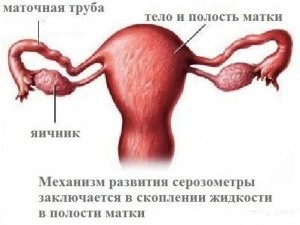 Serozometra menopauza kezelésére