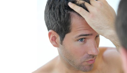 Peeling a fejbőr probléma okait, módszerek megelőzésére és kezelésére