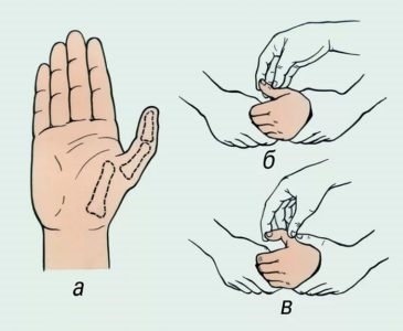 Zavar a hüvelykujj, kisujj a kéz, hogy mit kell csinálni, hogyan kell kezelni a tüneteket