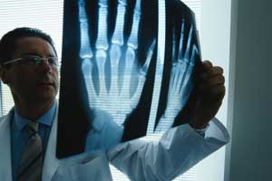 Osteoarthritis a csukló és a kis ízületek a kéz és tüneteinek kezelésére