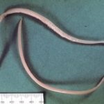 Worms az emberi seb kukacok és lárvái, a kezelés és fotó