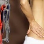 Diagnosztizálása a kiváltó okok és kezelési eljárások az artéria vertebrális szindróma